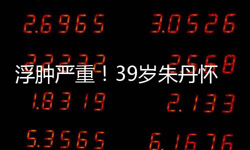 带货严重月 7个怀孕朱丹直播坚持浮肿9岁深夜
